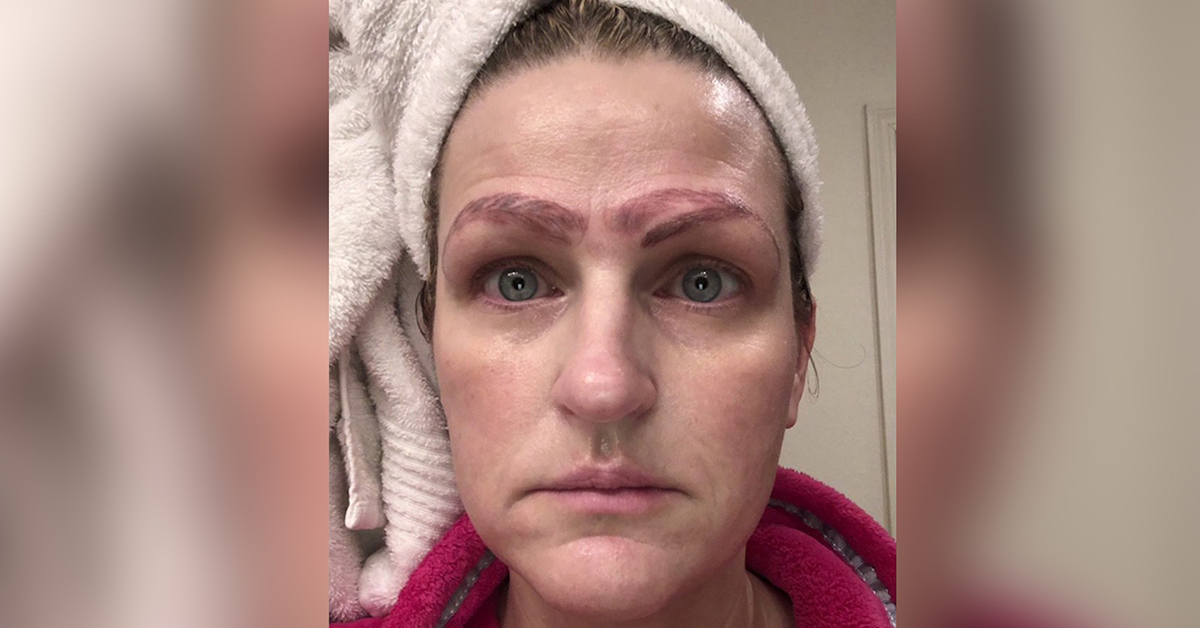 You are currently viewing ‘I looked hideous’: Botched microblading procedure leaves metro woman with ‘crazy brows’